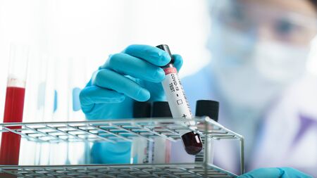 Coronavirus testing, a hand holds tube of blood test samples of coronavirus (COVID-19).