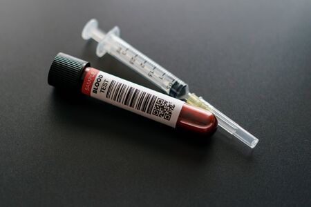 Coronavirus testing process, tube of blood test samples of coronavirus (COVID-19). (FAKE QR...