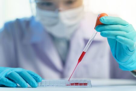 Pipette adding fluid to test tubes. laboratory assistant analysing a blood sample.