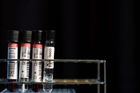 Coronavirus testing process, tube of blood test samples and swab collection kit of coronavirus...
