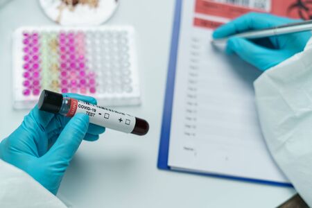 Scientist holding blood test samples tube in hand writing report information about blood test.Coronavirus testing process.の写真素材