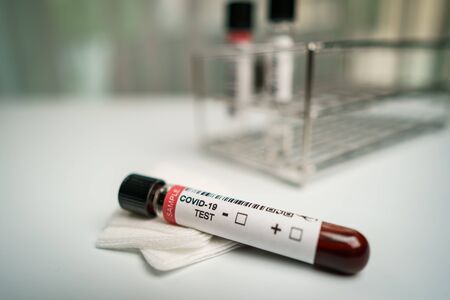 Coronavirus testing, a tube of blood test samples of coronavirus (COVID-19).の写真素材