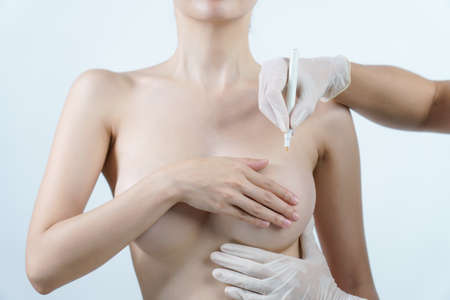 Doctor hand drawing lines on woman breast, breast implant surgery concept.の写真素材