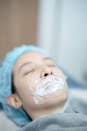 Esthetician applying numbing cream on patient's lips before injects filler.