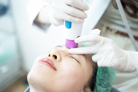 Beautician doing laser rejuvenation on woman face. Facial skin care.