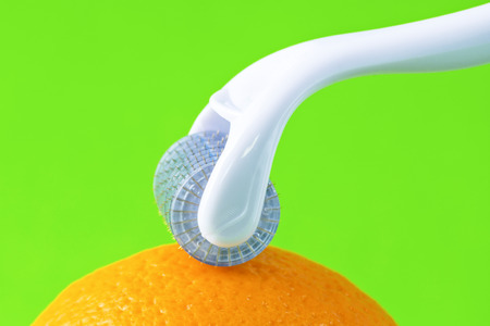Dermaroller for medical micro needling therapy. Tool also known as: Derma roller, mesoroller, meso-roller, mesopen.の写真素材