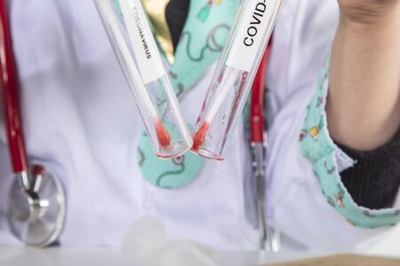 young doctor hold test tube with swab for coronavirusの写真素材