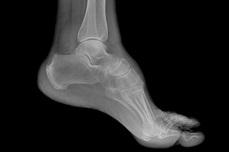 Foot radiography of a hospital patientの写真素材