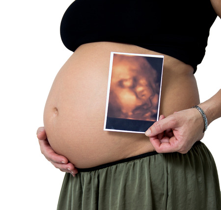 clouse-up of pregnant belly with ultrasound pictureの写真素材