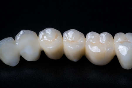 Dental crowns on a black background. Close-up.