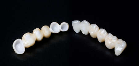 Dental crowns. Braces on a black background. Close-up.の写真素材