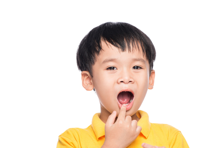 Lost milk tooth asian boy, Close up view.の写真素材