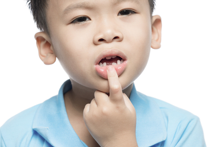 Lost milk tooth boy, Close up view.の写真素材