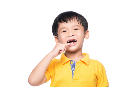 Lost milk tooth asian boy, Close up view.の写真素材
