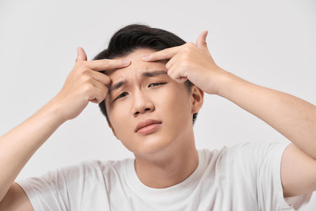 young man caring about acne, men's skincare conceptの写真素材