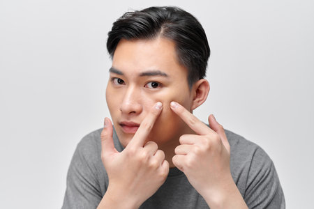 Close up photo of young man looking for acnes on his faceの写真素材