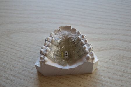Modern orthodontic teeth alignment plate made of colored plastic with metal clampsの写真素材