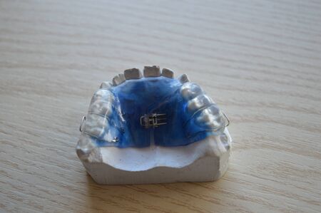 Modern orthodontic teeth alignment plate made of colored plastic with metal clampsの写真素材