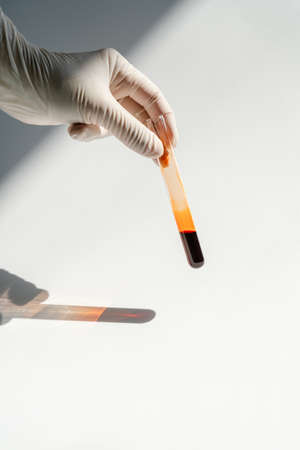 The hand holds a test tube with blood.の写真素材