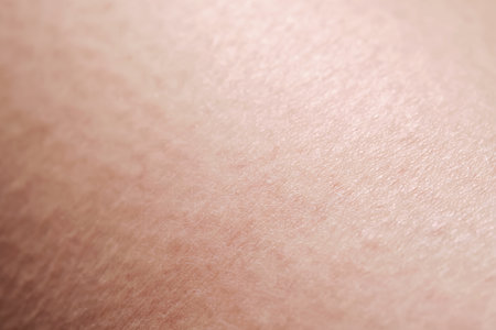 Human dry skin texture close-up.の写真素材