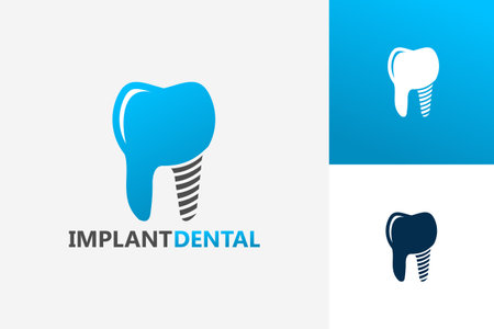 Implant Dental Logo Template Design Vector, Emblem, Design Concept, Creative Symbol, Iconのイラスト素材