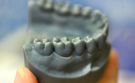 The lower jaw man, created on a 3d printer from a photopolymer material. Stereolithography 3D printer, technology of liquid photopolymerization under UV light. Modern additive and medical technologiesの写真素材