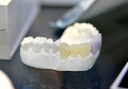 model of the human jaw with artificial teeth close-up