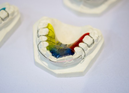 example of a bridge on an artificial human jaw close-upの写真素材