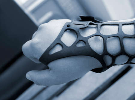 Black orthopedic plastic prosthesis printed on 3D printer on hand.の写真素材