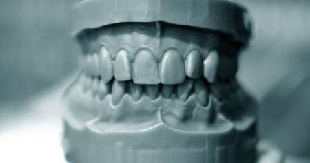 Upper and lower jaw of a man printed on a 3d printer of photopolymer. Stereolithography 3D printer, technology of liquid photopolymerization under UV light. Modern medical technologiesの写真素材