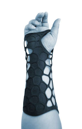 Orthopedic plastic prosthesis printed on powder 3D printer on hand isolated on white background. Gypsum close-up. Multi Jet Fusion MJF 3D printing technology. Modern progressive additive technology.の写真素材
