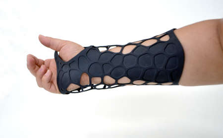 Orthopedic plastic prosthesis printed on powder 3D printer on hand isolated on white background. Gypsum close-up. Multi Jet Fusion MJF 3D printing technology. Modern progressive additive technology.の写真素材