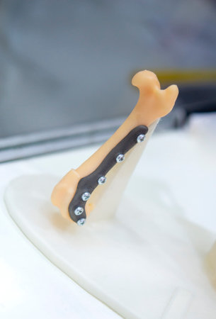 Implants and prostheses printed on 3D printer from biocompatible titanium powder. Plates for correction of deformation for animals. Titanium plates on animal bones printed on 3D printer.の写真素材