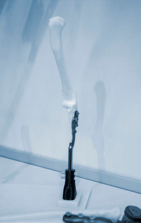 Biointegrated prosthetic limb for a dog close-up. Titanium plates on animal bones printed on 3D printer from plastic. Implants and prostheses printed on 3D printer from biocompatible titanium powder.の写真素材