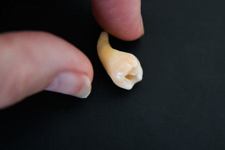 Human hand close to a extracted cheektooth. Black backgroundの写真素材