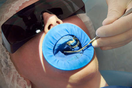 Patient getting dental treatment at dentist office with dental rubber dam protectionの写真素材