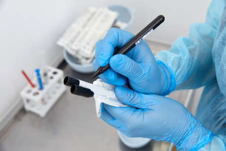 Scientist working with blood sample in laboratory