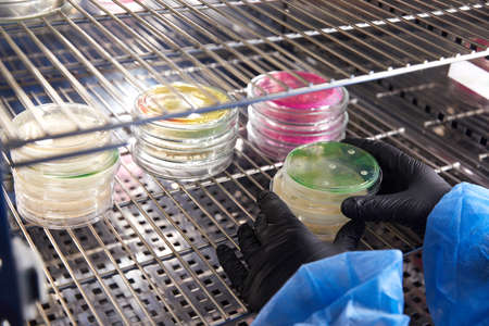 Gloved Hand of a Technician or scientist working with petri dish in microbiology laboratory....
