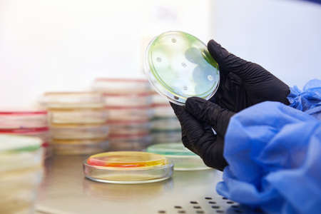 Gloved Hand of a Technician or scientist working with petri dish in microbiology laboratory....