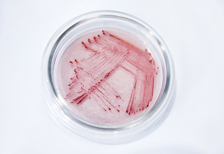 Microbiology Laboratory. Petri Dishes with Various Bacteria Samples