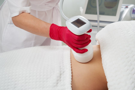 professional cosmetologist performing radiofrequency lifting procedure on the stomach of a womanの写真素材