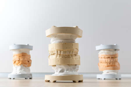 Dental model of human teeth made of gypsum. dental impressionの写真素材