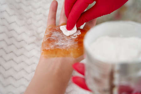 cosmetologist makes injections of botulinum toxin on the palms of a woman against hyperhidrosis. Female cosmetology, skinの写真素材