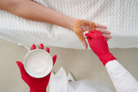 cosmetologist makes injections of botulinum toxin on the palms of a woman against hyperhidrosis. Female cosmetology, skinの写真素材