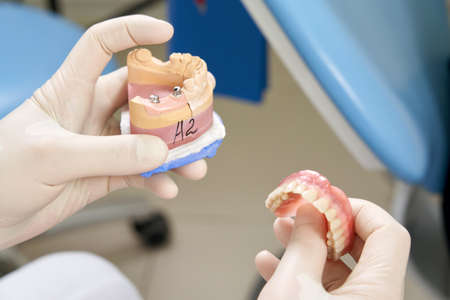 Male dentist showing his female patient a dental implant