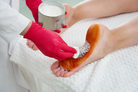 Doctor preparing to make injections of botulinum toxinon in female feet against hyperhidrosis, excessive sweatingの写真素材