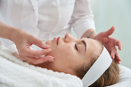 Young woman having an acupuncture treatment therapy on her face in spa salon. Alternative medicine...