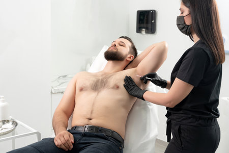 Doctor doing injection from hyperhidrosis. Man receiving an underarm treatment in cosmetology clinicの写真素材