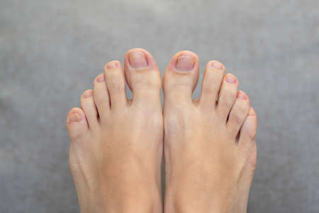 Closeup of female feet and toes on white background. Healthy feet concept