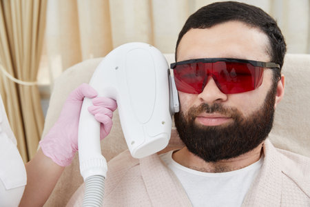 Bearded man getting laser facial treatment by professional cosmetologist in a beauty clinicの写真素材